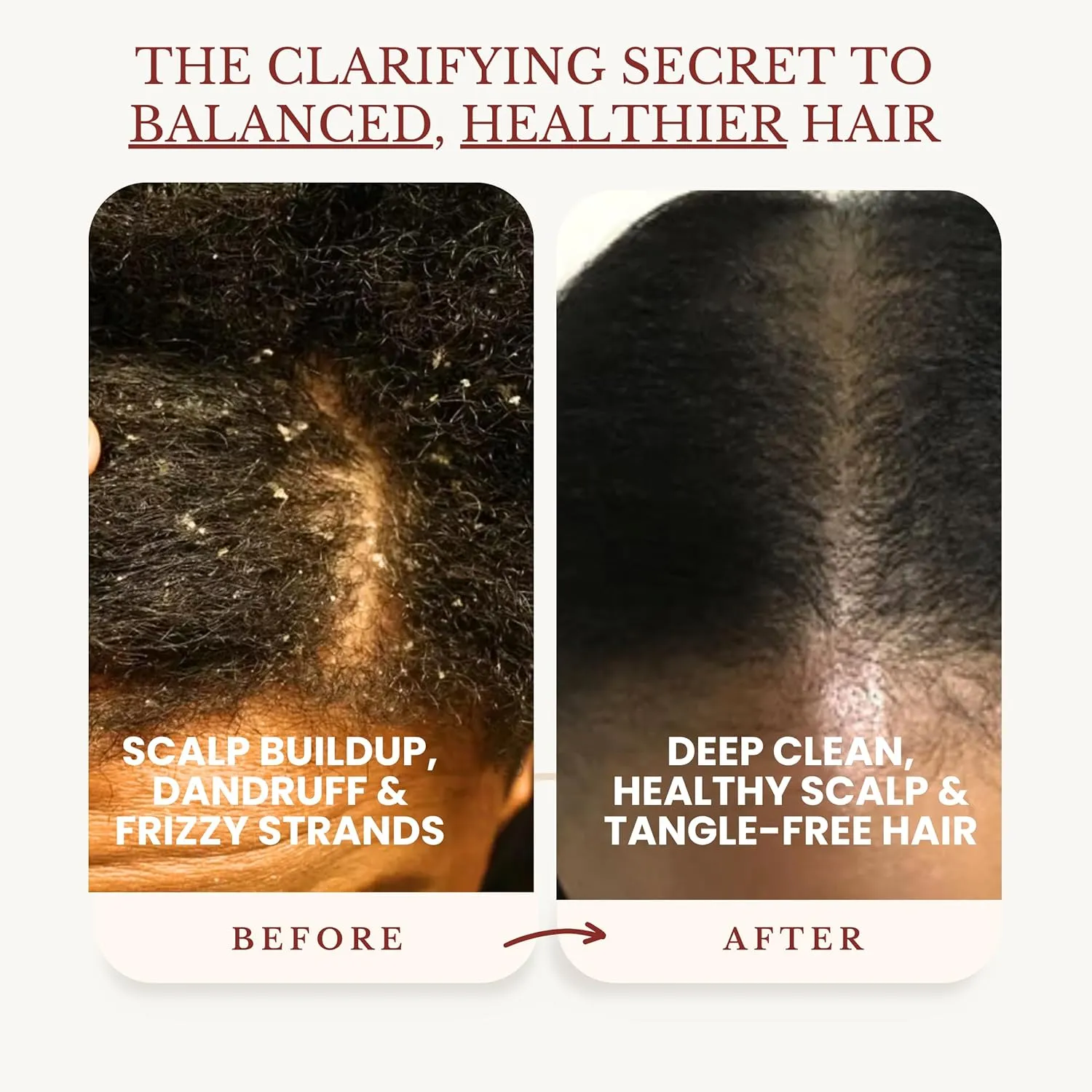 Apple Cider Vinegar (ACV) Shampoo & Conditioner | Clarifies, Balances pH, Detoxes Deep Cleanser for Scalp & Hair, Buildup Remover, Ideal for Locs, Curly, Oily Hair, 16 fl oz Each