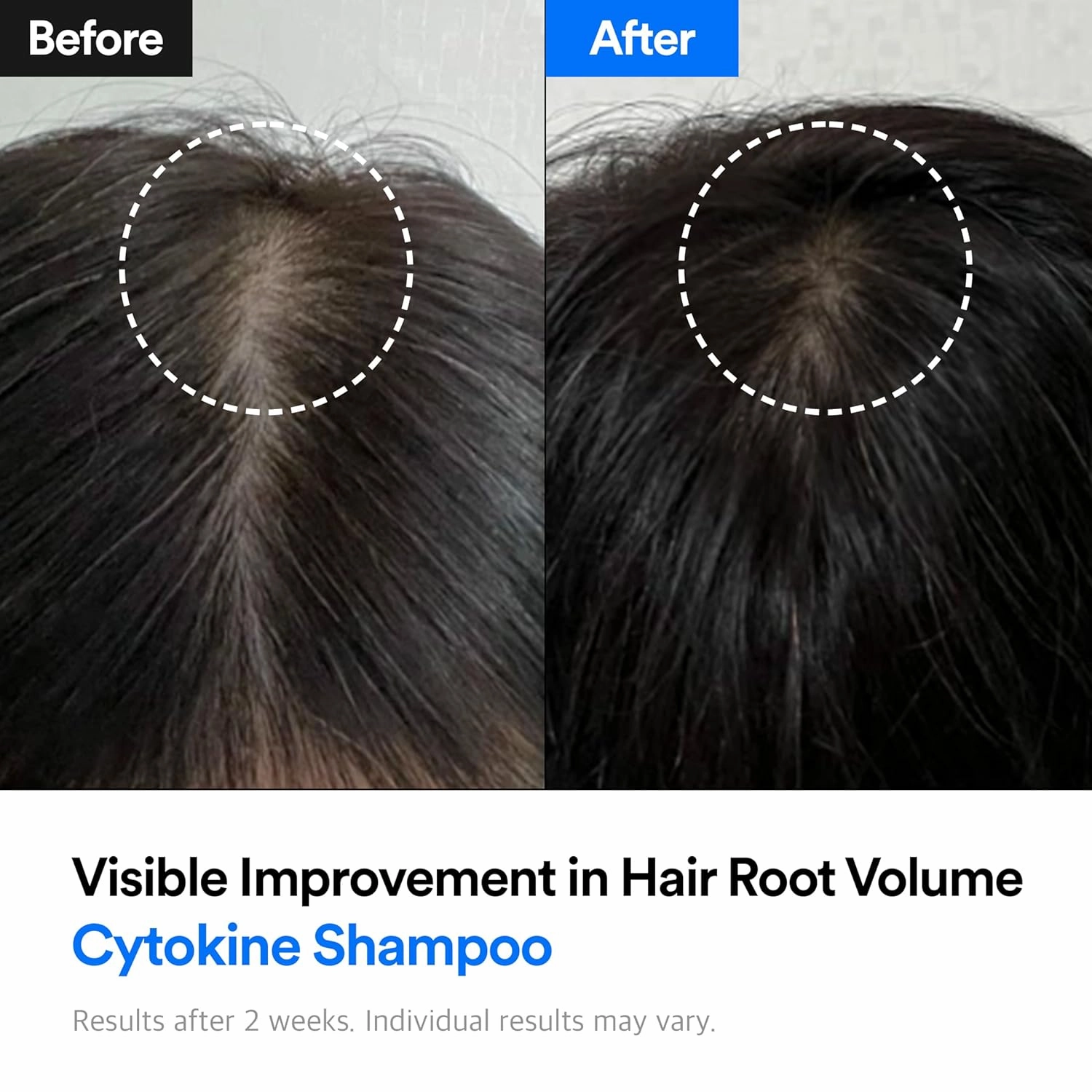 Refilled Hair-Recovery Cytokine Shampoo Plus Sebum Care,12.8 Fl. Oz. – Clarifying Hair Loss Shampoo for Thinning Hair & Oily Scalp, Deep Cleansing & Detox Shampoo, Sulfate-Free Formula